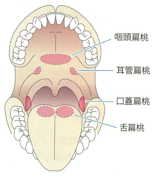 扁桃線