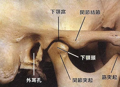 顎関節症